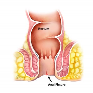 little anal treatment