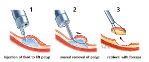 endoscopic-surgery_e